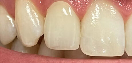 Smile photo1